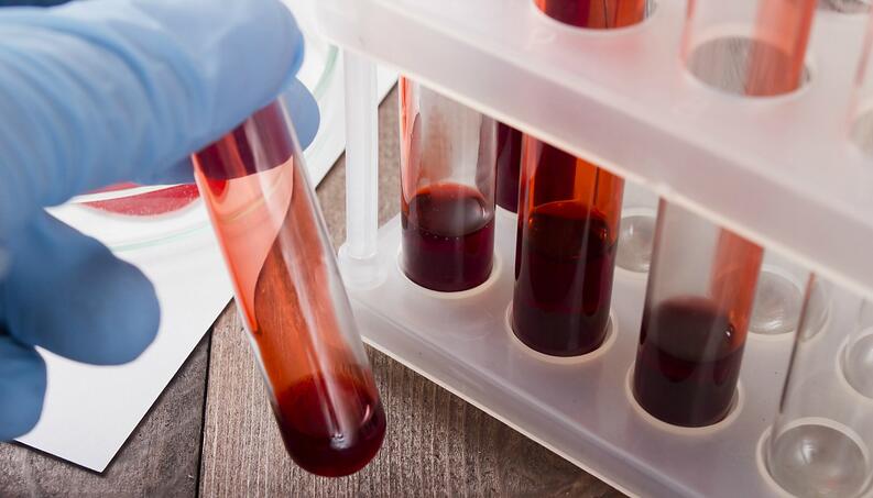 exame sangue desnecessario 1116 1400x800